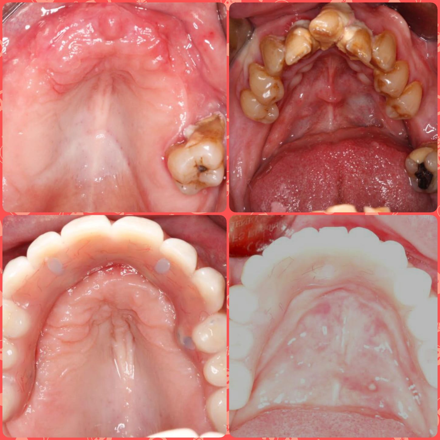 Dental Images